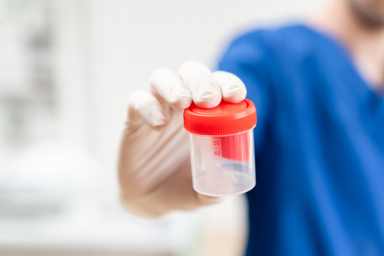 Should Your Business Require Post-Offer Drug Testing?